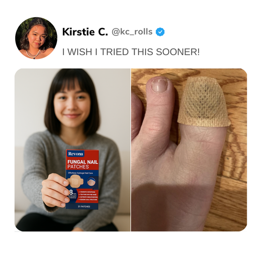 My battle with toenail fungus: How I Finally Found Relief and Got My Confidence Back